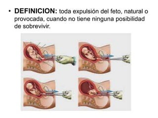 • DEFINICION: toda expulsión del feto, natural o
provocada, cuando no tiene ninguna posibilidad
de sobrevivir.
