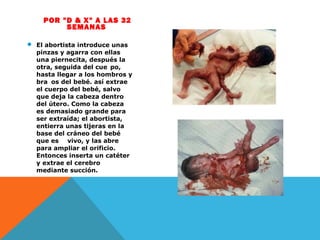 POR "D & X" A LAS 32
SEMANAS
 El abortista introduce unas
pinzas y agarra con ellas
una piernecita, después la
otra, seguida del cuerpo,
hasta llegar a los hombros y
brazos del bebé. así extrae
el cuerpo del bebé, salvo
que deja la cabeza dentro
del útero. Como la cabeza
es demasiado grande para
ser extraída; el abortista,
entierra unas tijeras en la
base del cráneo del bebé
que está vivo, y las abre
para ampliar el orificio.
Entonces inserta un catéter
y extrae el cerebro
mediante succión.

 