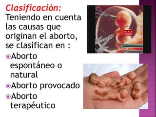 Clasificación:
Teniendo en cuenta
las causas que
originan el aborto,
se clasifican en :
Aborto
espontáneo o
natural
Aborto provocado
Aborto
terapéutico
 