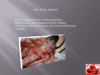 QUE ES EL ABORTO
ES LA INERRUPCION Y FINALIZACION
PREMATURA DEL EMBARAZO DE FORMA
NATURAL O INTENCIONAL EN UN SENTIDO MAS
AMPLIO.
 