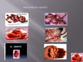IMÁGENES DE ABORTO
 
