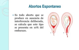 Abortos Espontaneo
 Es todo aborto que se
produce en ausencia de
interferencia deliberada,
se calcula que este tipo
se presenta en 10% del
embarazo.
 