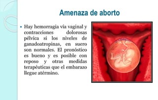 Amenaza de aborto
 Hay hemorragia vía vaginal y
contracciones dolorosas
pélvica si los niveles de
ganadoatropinas, en suero
son normales. El pronóstico
es bueno y es posible con
reposo y otras medidas
terapéuticas que el embarazo
llegue atérmino.
 