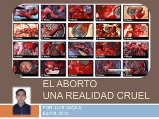 EL ABORTO
UNA REALIDAD CRUEL
POR: LUIS VACA S.
ESPOL 2010
 