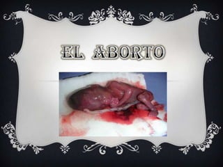 El  aborto  