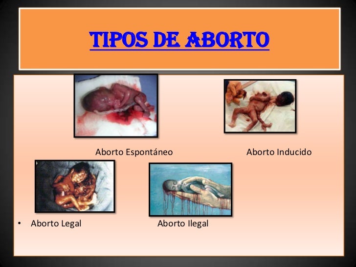 Resultado de imagen para TIPOS DE ABORTO