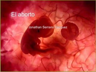 El aborto
Jonathan Serrano Vázquez
 