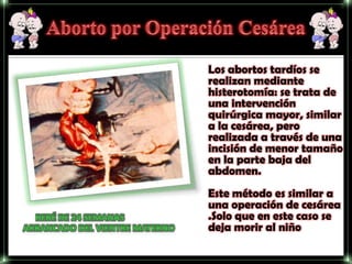 Los abortos tardíos se
realizan mediante
histerotomía: se trata de
una intervención
quirúrgica mayor, similar
a la cesárea, pero
realizada a través de una
incisión de menor tamaño
en la parte baja del
abdomen.
Este método es similar a
una operación de cesárea
.Solo que en este caso se
deja morir al niño
 