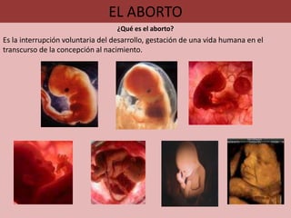 EL ABORTO
                                   ¿Qué es el aborto?
Es la interrupción voluntaria del desarrollo, gestación de una vida humana en el
transcurso de la concepción al nacimiento.
 