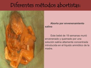 Diferentes métodos abortistas:


                   Aborto por envenenamiento
              salino


                   Este bebé de 19 semanas murió
              envenenado y quemado por una
              solución salina altamente concentrada
              introducida en el líquido amniótico de la
              madre.
 
