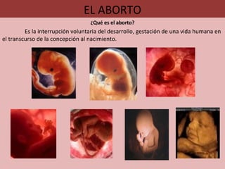 EL ABORTO ¿Qué es el aborto? Es la interrupción voluntaria del desarrollo, gestación de una vida humana en el transcurso de la concepción al nacimiento. 
