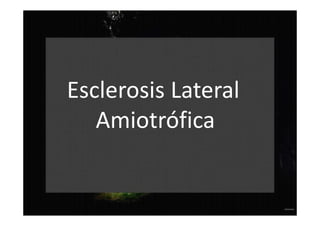 Esclerosis Lateral
Amiotrófica
 