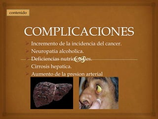 contenido




           Incremento de la incidencia del cancer.
           Neuropatia alcoholica.
           Deficiencias nutricionales.
           Cirrosis hepatica.
           Aumento de la presion arterial
 