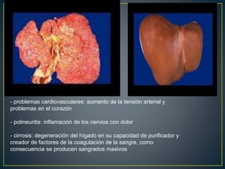 - problemas cardiovasculares: aumento de la tensión arterial y
problemas en el corazón
- polineuritis: inflamación de los nervios con dolor
- cirrosis: degeneración del hígado en su capacidad de purificador y
creador de factores de la coagulación de la sangre, como
consecuencia se producen sangrados masivos
 