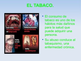 EL TABACO.

     
         El consumo de
         tabaco es uno de los
         hábitos más dañinos
         para la salud que
         puede adquirir una
         persona.
     
         Su abuso conduce al
         tabaquismo, una
         enfermedad crónica.
 
