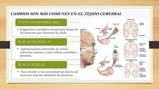 CAMBIOS SON MÁS COMUNES EN EL TEJIDO CEREBRAL 
NUDOS NEUROFIBRILARES 
• Fragmentos enrollados de proteína dentro de 
las neuronas que obstruyen la célula 
PLACAS NEURÍTICAS 
• Aglomeraciones anormales de células 
nerviosas muertas y otras células cerebrales y 
proteína. 
PLACAS SENILES 
• Áreas donde se han acumulado productos de 
neuronas muertas alrededor de proteínas. 
 