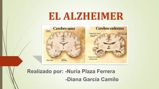 EL ALZHEIMER
Realizado por: -Nuria Plaza Ferrera
-Diana García Camilo
 