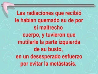 Las radiaciones que recibió le habían quemado su de por si maltrecho   cuerpo, y tuvieron que mutilarle la parte izquierda de su busto,  en un desesperado esfuerzo por evitar la metástasis.   