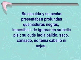 Su espalda y su pecho presentaban profundas quemaduras negras,  imposibles de ignorar en su bella piel; su cutis lucia pálido, seco,  cansado, no tenía cabello ni cejas.   