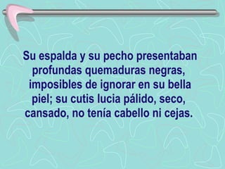 Su espalda y su pecho presentaban profundas quemaduras negras,  imposibles de ignorar en su bella piel; su cutis lucia pálido, seco,  cansado, no tenía cabello ni cejas.   