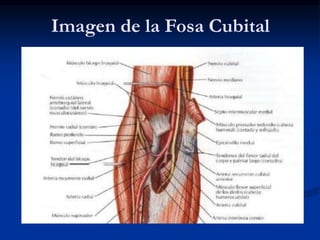 Imagen de la Fosa Cubital
 