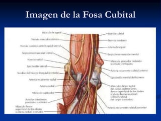 Imagen de la Fosa Cubital
 