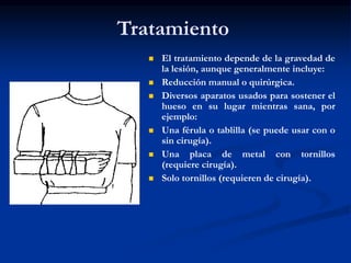 Tratamiento
 El tratamiento depende de la gravedad de
la lesión, aunque generalmente incluye:
 Reducción manual o quirúrgica.
 Diversos aparatos usados para sostener el
hueso en su lugar mientras sana, por
ejemplo:
 Una férula o tablilla (se puede usar con o
sin cirugía).
 Una placa de metal con tornillos
(requiere cirugía).
 Solo tornillos (requieren de cirugía).
 
