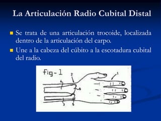 La Articulación Radio Cubital Distal
 Se trata de una articulación trocoide, localizada
dentro de la articulación del carpo.
 Une a la cabeza del cúbito a la escotadura cubital
del radio.
 