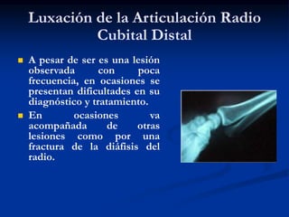 Luxación de la Articulación Radio
Cubital Distal
 A pesar de ser es una lesión
observada con poca
frecuencia, en ocasiones se
presentan dificultades en su
diagnóstico y tratamiento.
 En ocasiones va
acompañada de otras
lesiones como por una
fractura de la diáfisis del
radio.
 