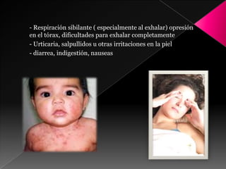 - Respiración sibilante ( especialmente al exhalar) opresión
en el tórax, dificultades para exhalar completamente
- Urticaria, salpullidos u otras irritaciones en la piel
- diarrea, indigestión, nauseas
 
