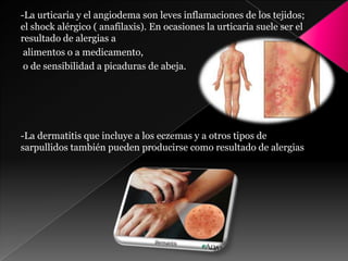 -La urticaria y el angiodema son leves inflamaciones de los tejidos;
el shock alérgico ( anafilaxis). En ocasiones la urticaria suele ser el
resultado de alergias a
alimentos o a medicamento,
o de sensibilidad a picaduras de abeja.
-La dermatitis que incluye a los eczemas y a otros tipos de
sarpullidos también pueden producirse como resultado de alergias
 
