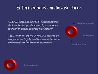 Enfermedades cardiovasculares LA ARTERIOSCLEROSIS. Endurecimiento de las arterias  producido al depositarse en su interior placas de grasa y colesterol EL INFARTO DE MIOCARDIO. Muerte de una parte del tejido cardiaco producida por la obstrucción de las arterias coronarias. Arteria sana Arteriosclerosis Luz de la arteria Pared de la arteria 