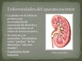  La piedra en el riñón se

produce por
acumulación de
sustancias de desecho y
sales minerales en el
riñón de forma excesiva.
 Se atascan y se
acumulan, formándose
como “piedras”. Se les
denomina “cálculos
renales”.
 Expulsarlas duele
bastante.

Piedra en el riñón

 
