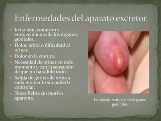  Irritación, comezón y









enrojecimiento de los órganos
genitales.
Dolor, ardor o dificultad al
orinar.
Dolor en la cintura.
Necesidad de orinar en todo
momento y con la sensación
de que no ha salido todo.
Salida de gotitas de orina a
cada momento sin poderla
controlar.
Tener fiebre sin motivo
aparente.

Enrojecimiento de los órganos
genitales

 
