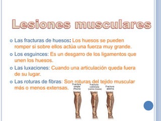    Las fracturas de huesos: Los huesos se pueden
    romper si sobre ellos actúa una fuerza muy grande.
   Los esguinces: Es un desgarro de los ligamentos que
    unen los huesos.
   Las luxaciones: Cuando una articulación queda fuera
    de su lugar.
   Las roturas de fibras: Son roturas del tejido muscular
    más o menos extensas.
 