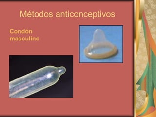 Métodos anticonceptivos
Condón
masculino
 