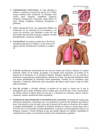 MATURITA DE BIOLOGÍA
GBZA
Rafael A. Medel Martínez
5
• ENFERMEDADES INFECCIOSAS; la zona afectada se
inflama y aumenta la secreción de mucus, tos y fiebre,
aunque también dolor localizado. Se distingue entre
catarro nasal, faringitis, amigdalitis (anginas),
bronquitis, bronquiolitis o neumonía, según afecte a la
nariz, faringe, amígdalas, bronquios, bronquiolos o
pulmones.
• ASMA: obstrucción de las vías respiratorias debido a la
contracción de los músculos de los bronquios y un
exceso de secreción, que dificultan el paso del aire
provocando una sensación de ahogo y angustia. Se debe
principalmente a reacciones alérgicas.
• NEUMOTÓRAX. Se produce cuando una o dos de las
membranas pleurales se rompen y el aire entra en el
espacio pleural, haciendo que el pulmón se colapse.
• CÁNCER: proliferación incontrolada de una masa de células que invade y destruye los tejidos
próximos. Puede ser de laringe, de tráquea o de pulmón (muy frecuente). Se produce en la
mucosa de los bronquios en su entrada al pulmón. Síntomas: pérdida de voz, tos creciente y
persistente, expectoraciones sanguinolentas y dolores en el tórax. Las personas fumadoras tienen
una mayor probabilidad de desarrollar dicha enfermedad. También los no fumadores, pero
expuestos a ambientes donde hay humo procedente del tabaco tienen mayor riesgo de sufrir
cáncer de pulmón.
• MAL DE ALTURA: a elevadas altitudes, la presión de los gases es menor por lo que la
hemoglobina de la sangre transporta menos oxígeno que a nivel del mar. Como, consecuencia,
las células reciben un aporte menor de este gas y se producen los síntomas: mareos, sofocos,
cansancio, vómitos, aumento del ritmo respiratorio.
• SÍNDROME DE DESCOMPRESIÓN O ENFERMEDAD DE LOS BUZOS: las botellas de oxígeno que
utilizan los buceadores, suministran aire a los pulmones a la presión del ambiente que rodea al
buzo. Esta presión es muy elevada y hace que la mayoría de los gases se disuelvan en la sangre.
A grandes profundidades, el contenido de nitrógeno disuelto en sangre es mucho mayor que a
nivel del mar. Si un buceador asciende rápidamente, se produce una descompresión brusca y el
nitrógeno empieza a formar burbujas de gas que pueden taponar los capilares impidiendo la
circulación de la sangre. Los síntomas son dolor en las articulaciones y parálisis.
 