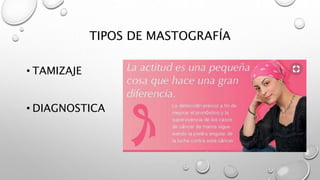 El arte de la mastografia en el diagnostico Slide 16