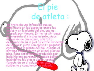 El pie
de atleta :
• se trata de una infección que se
manifiesta en los espacios entre los
dedos y en la planta del pie, que es
causada por hongos. Entre los síntomas
se presenta el enrojecimiento, picor,
sensación de quemazón, grietas o
descamación en la piel de entre los dedos
de los pies; junto con apoyas o pequeñas
escamas en la planta del pie. Aunque el
síntoma más evidente es el mal olor de
pies. Esta enfermedad producida por
mala higiene personal se puede paliar
lavándonos los pies a diario, usando
funguicida en el calzado en caso de
sospecha y cambiando de calzado.
 