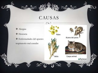 AlergiasHerenciaEnfermedades del aparato respiratorio mal curadascausas
