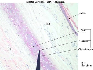 Elastic Cartilage. (M.P). H&E stain.
In:-
Ear pinna
Chondrocyte
lacuna
nest
Skin
C.T
C.T
 