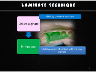 Chilled alginate
Syringe agar
Gels by chemical reaction
Gels by means of contact with the cool
alginate
38
 