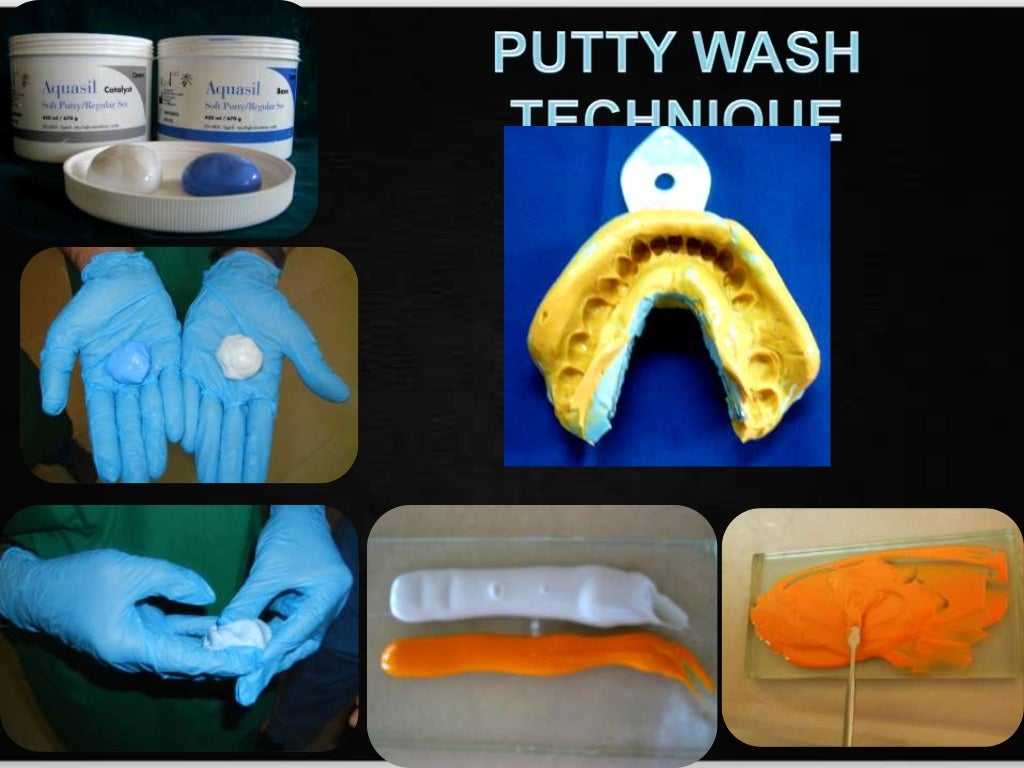 Elastic impression materials abhishek kavlekar