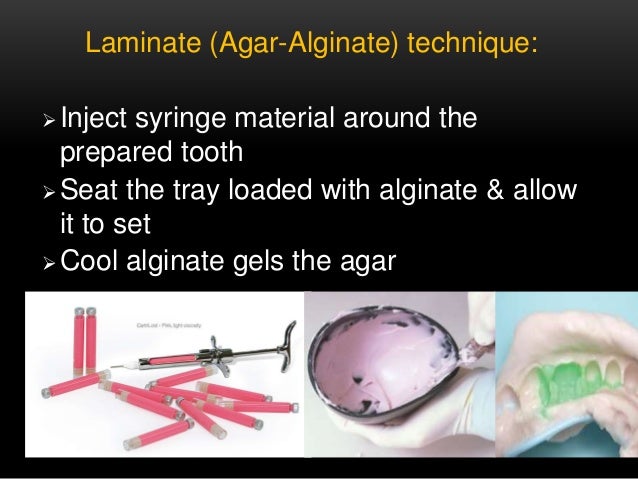 agar dental impression material agar dental impression material