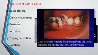 Clinical uses of class I elastics :-
1. Space closing.
2. Dental movements
3. Extrusion
4. Intrusion
5.Tipping correction
6. Rotation
 
