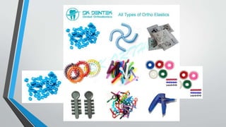 Separators
ligatures bands
chains
Elastomeric materials:
 