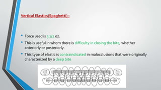 Vertical Elastics(Spaghetti) :
• Force used is 3 1/2 oz.
• This is useful in whom there is difficulty in closing the bite, whether
anteriorly or posteriorly.
• This type of elastic is contraindicated in malocclusions that were originally
characterized by a deep bite
 