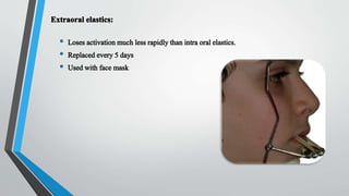 Proper _ Elastics _ in _ orthontics .pptx