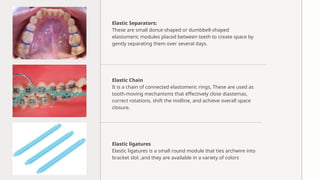 Elastic Module Ortho Comprehensive Overview of Orthodontic Elastics: Types, Uses, and ...