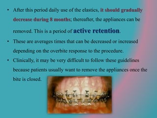 • After this period daily use of the elastics, it should gradually
decrease during 8 months; thereafter, the appliances can be
removed. This is a period of active retention.
• These are averages times that can be decreased or increased
depending on the overbite response to the procedure.
• Clinically, it may be very difficult to follow these guidelines
because patients usually want to remove the appliances once the
bite is closed.
 